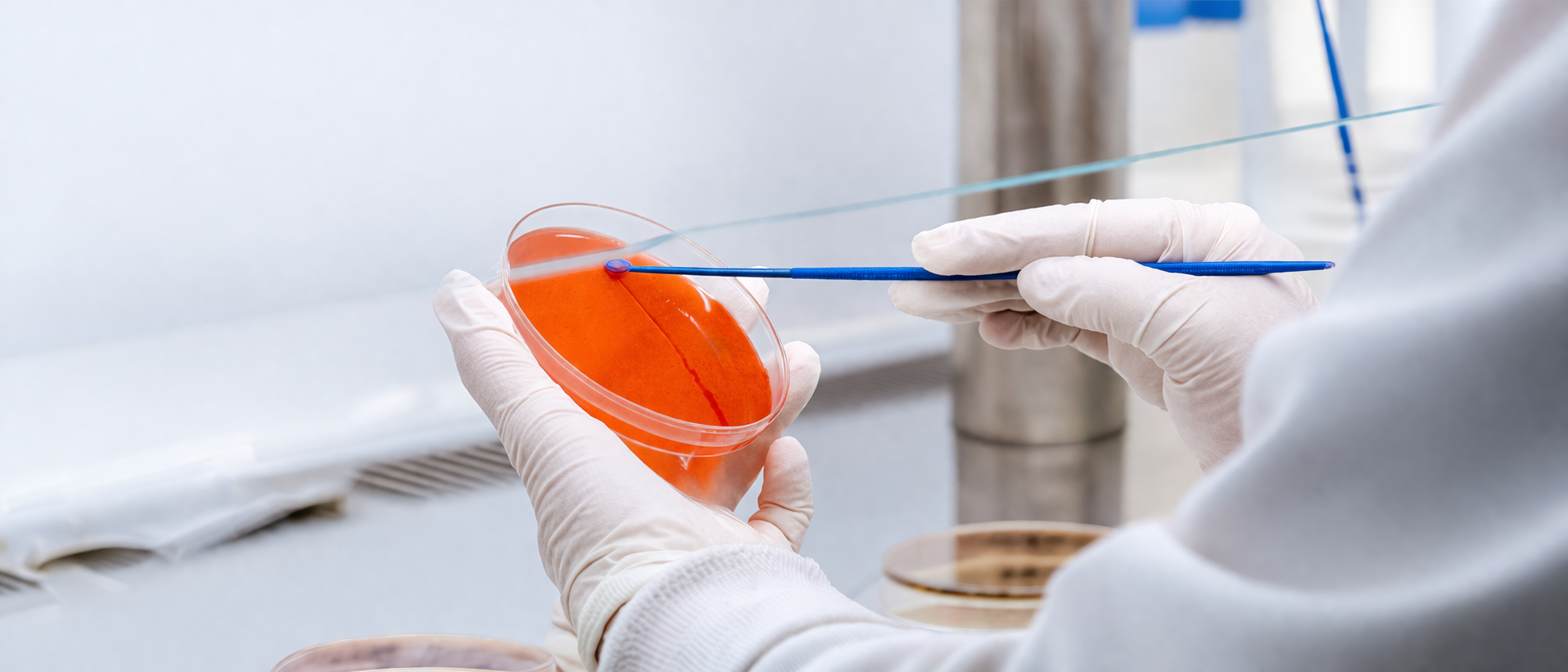 ABSD platform for diagnostic discs